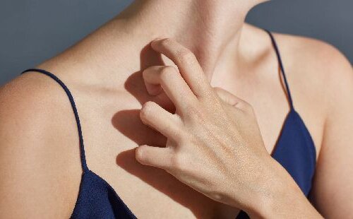 Boutons d’allergie au soleil : quels sont les traitements pour les faire disparaitre ?