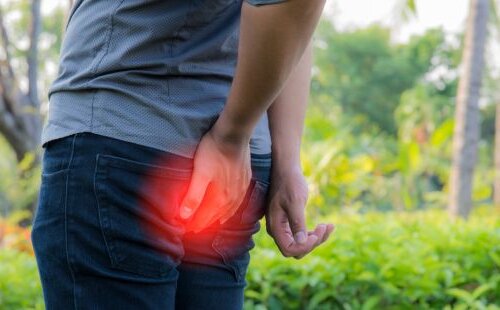 Comprendre et traiter la crise hémorroïdaire : causes, symptômes et solutions