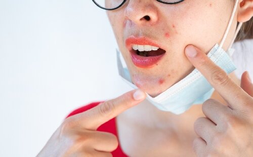 Maskné : comment adapter sa routine beauté au port du masque ?