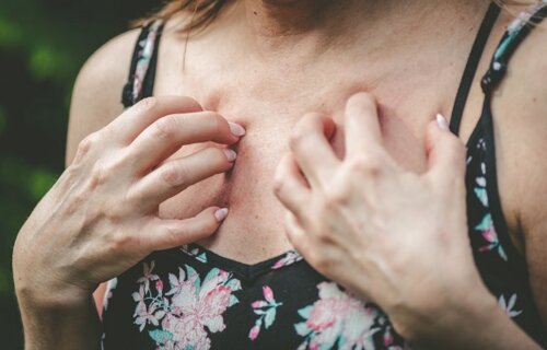 Allergie au soleil : causes, prévention et traitement