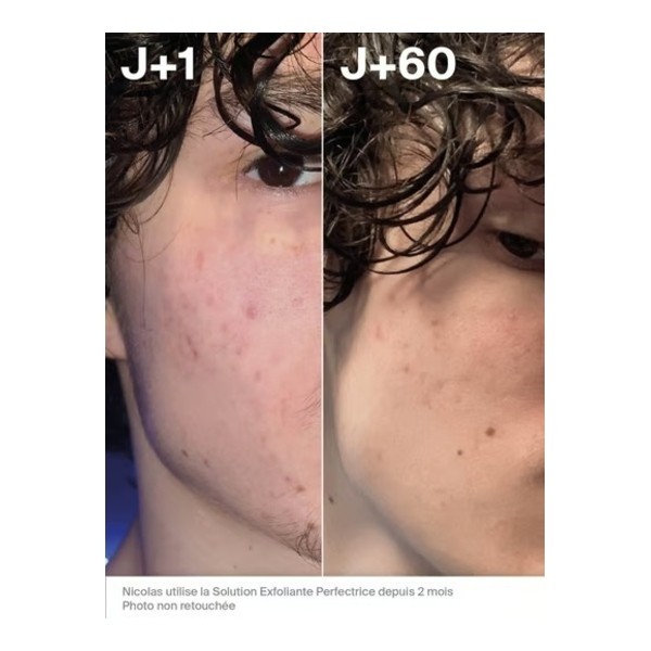 Horace Solution exfoliante perfectrice