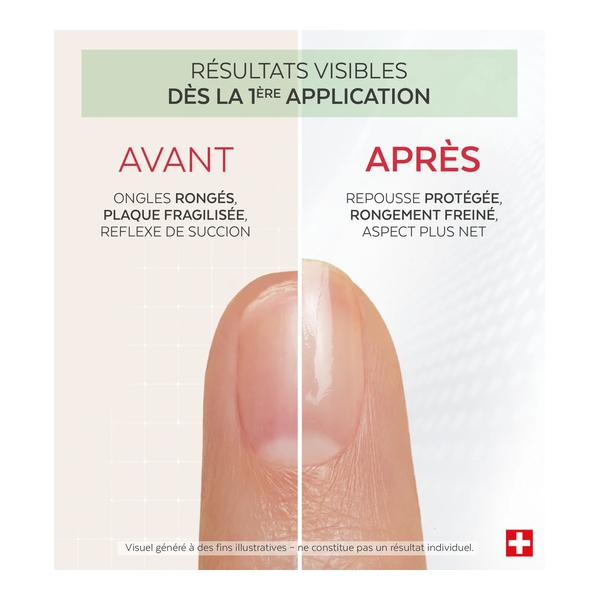 Poderm Nail corrector vernis amer