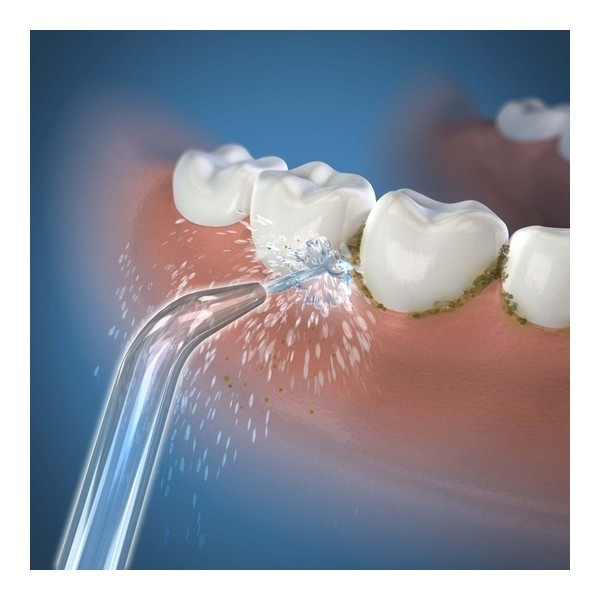Embout pour hydropulseur Waterpik