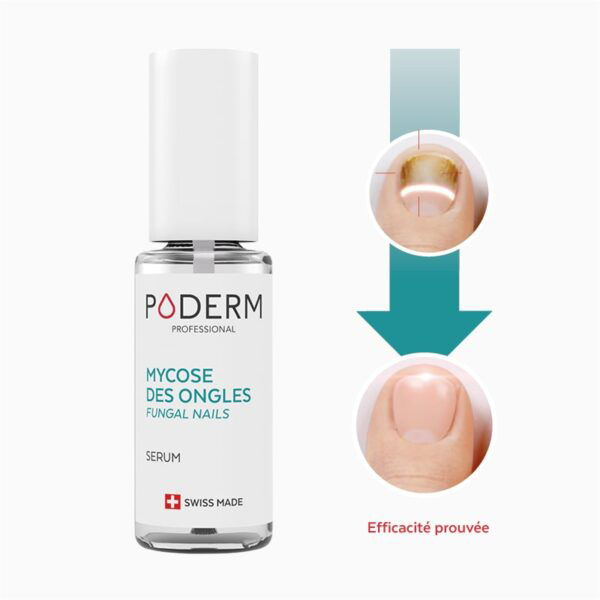 Poderm Huile Sérum Mycose des ongles