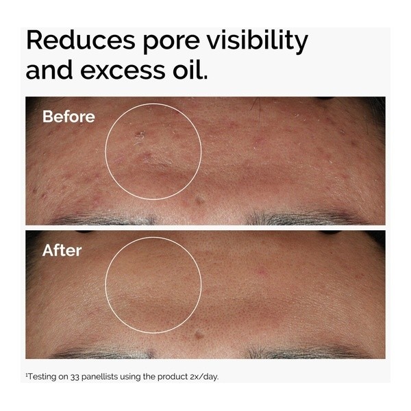 The Ordinary Sérum Niacinamide 10% + Zinc 1%