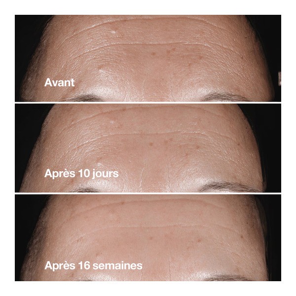 Clinique Smart clinical repair Sérum correcteur anti rides