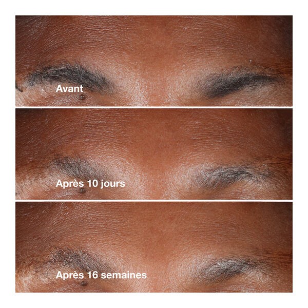 Clinique Smart clinical repair Sérum correcteur anti rides