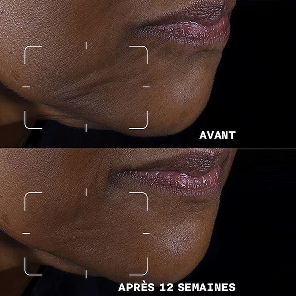 Clinique Smart Clinical Repair Crème liftante visage + cou