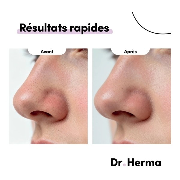 Dr Herma Patch anti points noirs pour le nez