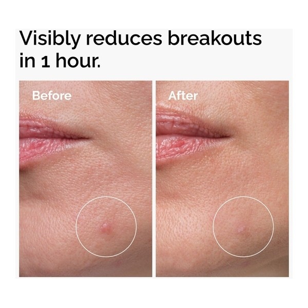 The Ordinary Concentré Crème en poudre de soufre 10%