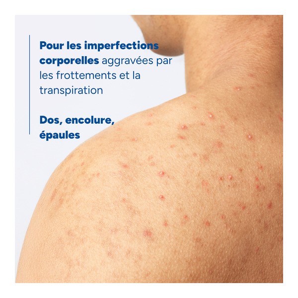 Ducray Keracnyl Spray corps asséchant anti boutons
