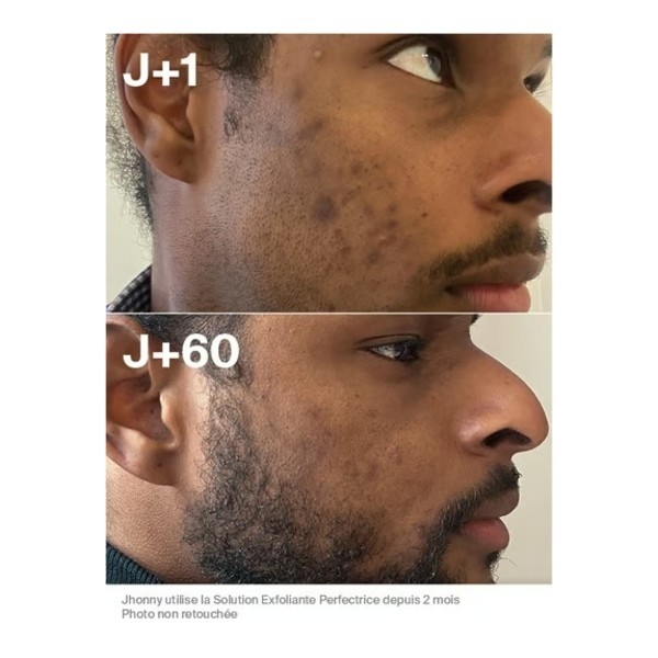 Horace Solution exfoliante perfectrice