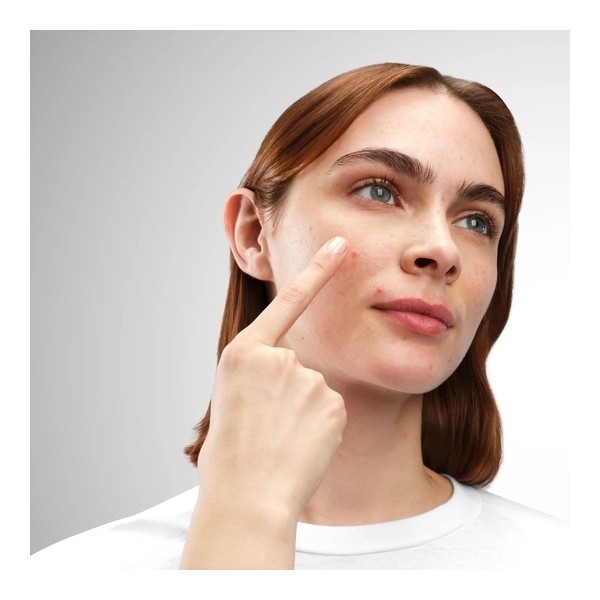 The Ordinary Concentré Crème en poudre de soufre 10%