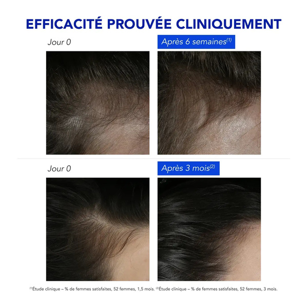 Phytophanère Antichute réactionnelle ampoule