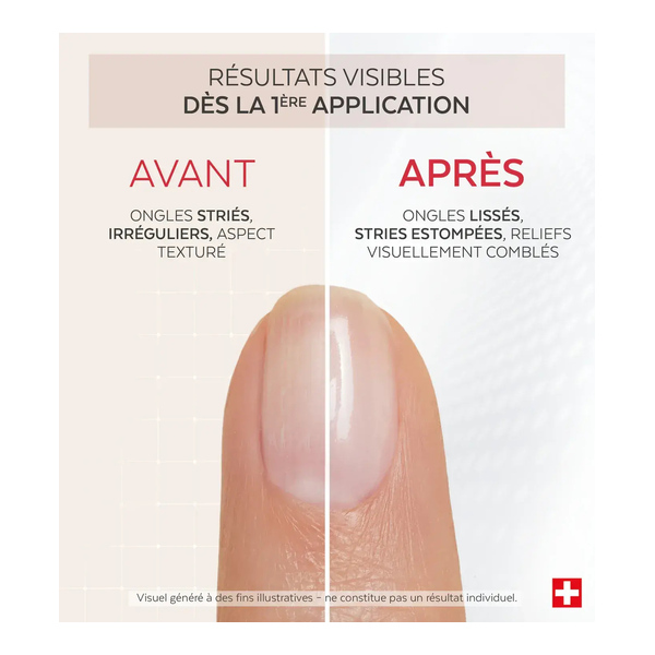 Poderm Nail corrector Comblant