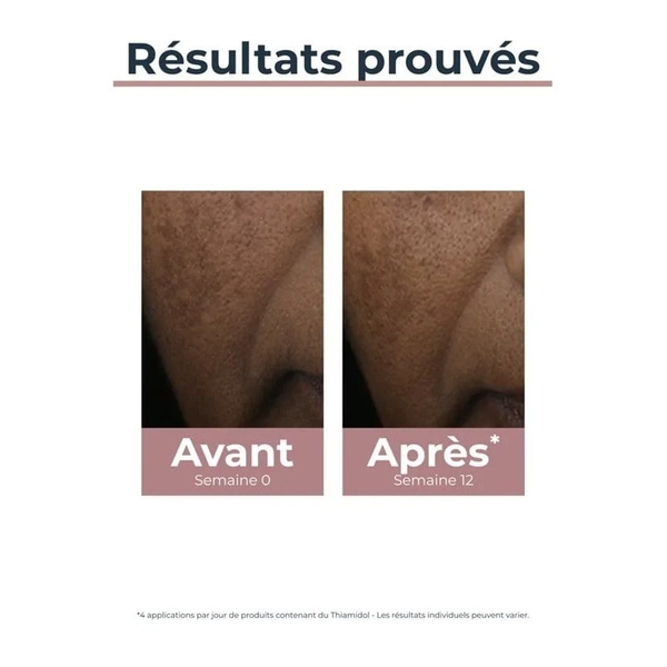 Eucerin Anti Pigment correcteur de taches