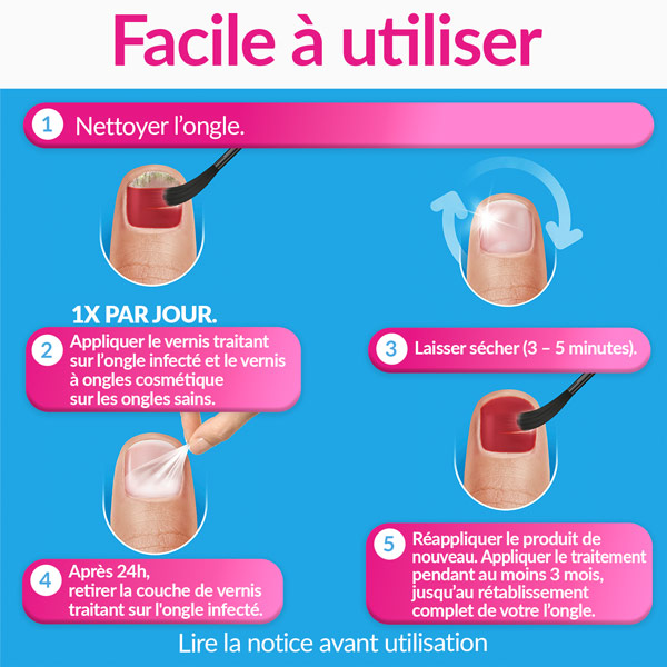 Excilor Forte Color vernis mycose ongle