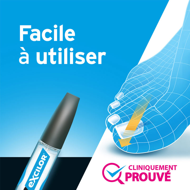 Excilor Traitement contre la mycose de l'ongle