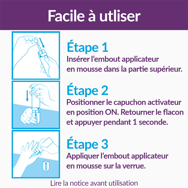 Excilor Verrue traitement par cryothérapie