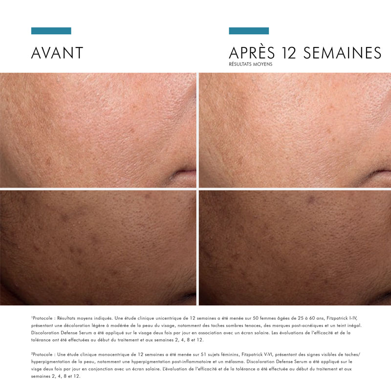 SkinCeuticals Discoloration Defense Serum