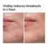 The Ordinary Concentré Crème en poudre de soufre 10%