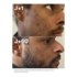 Horace Solution exfoliante perfectrice