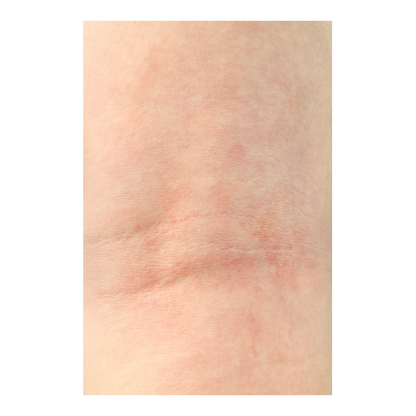 Dexeryl Crème sécheresse cutanée