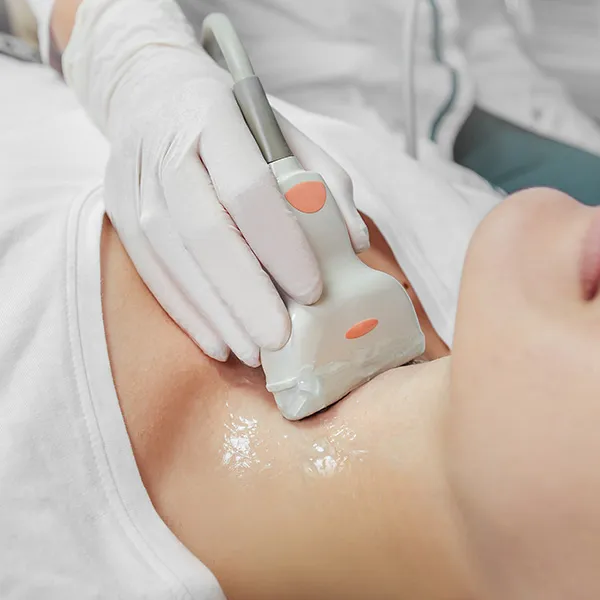 Gel de contact lubrifiant Supragel