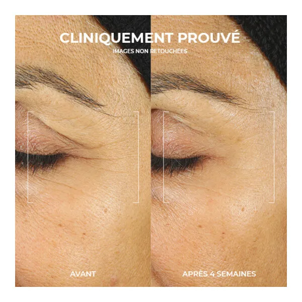 Roc Retinol Correxion Crème contour des yeux