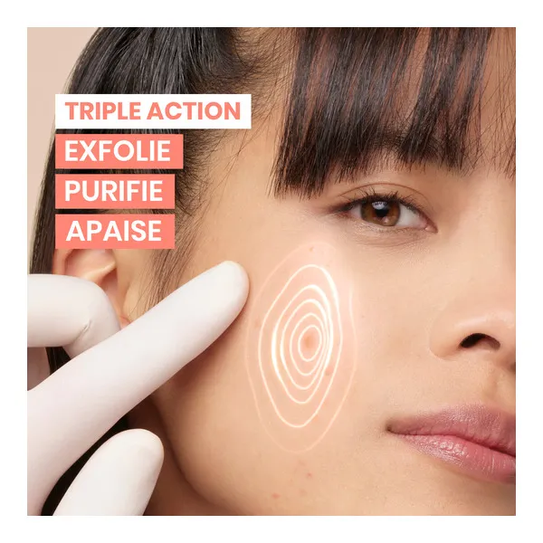 Avène Cleanance Comedomed Gel Nettoyant Peeling