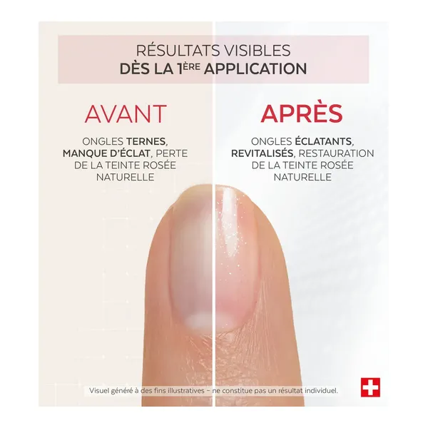 Poderm Nail corrector Booster Eclat