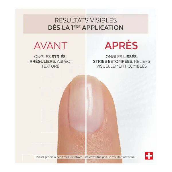 Poderm Nail corrector Comblant