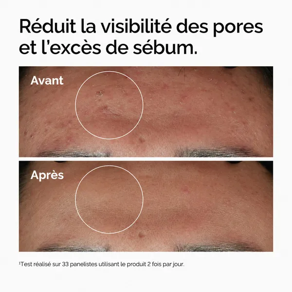 The Ordinary Sérum Niacinamide 10% + Zinc 1%