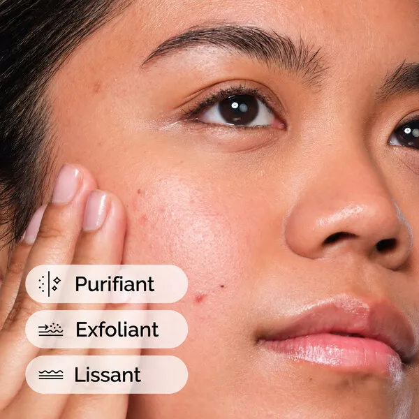 The Ordinary Solution à l'acide salicylique 2%