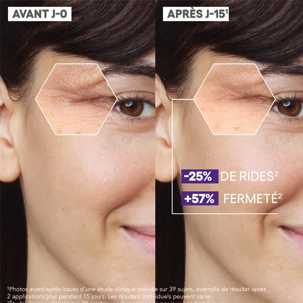 A Derma Epitheliale Ultra Repair HA+ sérum multi réparateur