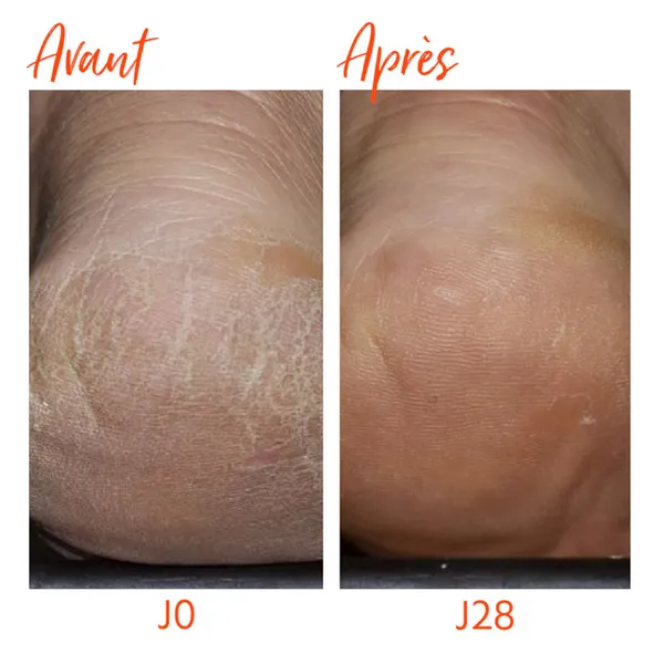 Aldaviem Soin Protection Intense Pieds et mains