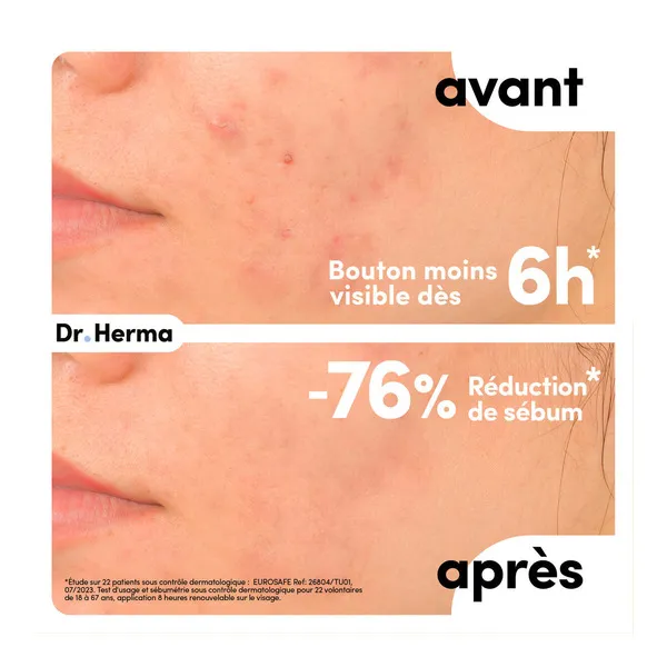 Dr Herma Patch anti boutons​ format Large