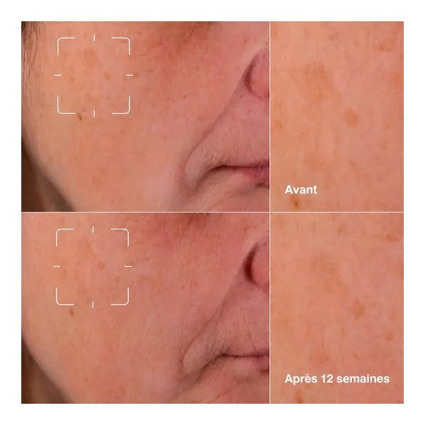 Clinique even better clinical sérum illuminateur anti taches