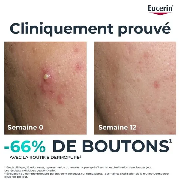 Eucerin DermoPure Fluide Triple correction