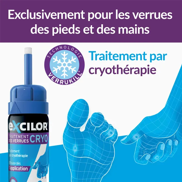 Excilor Verrue traitement par cryothérapie