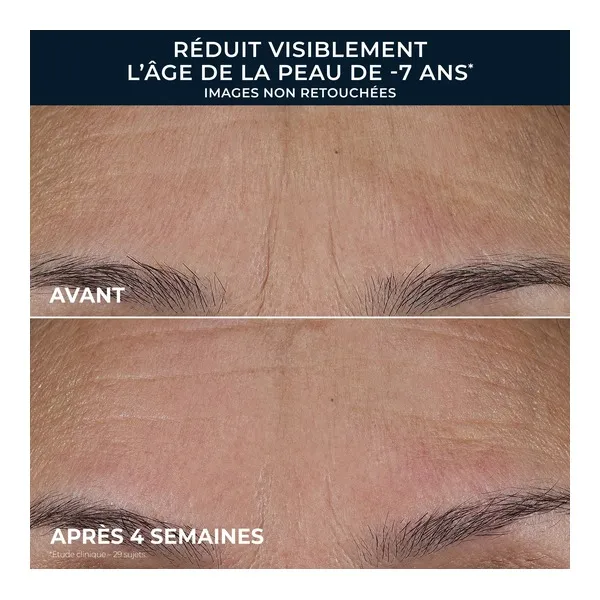 Roc Retinol Correxion Lissant rides Triple sérum