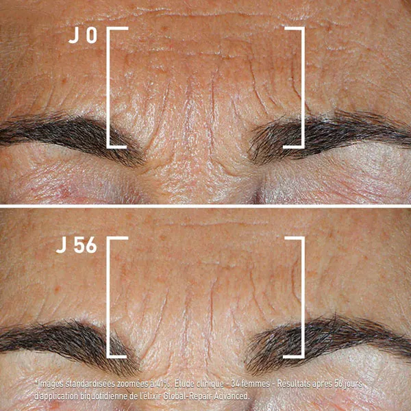 Filorga Global Repair Advanced Elixir intensif jeunesse