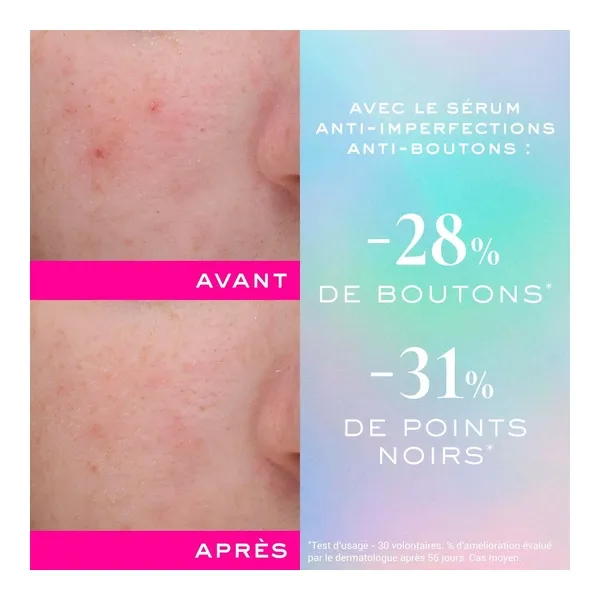 Nuxe Zinc Power Sérum Anti imperfections Anti boutons