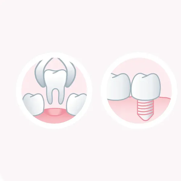 Gum Brosse à dents Post-Operation