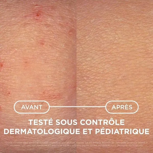 Bioderma Atoderm AD Intensive Baume