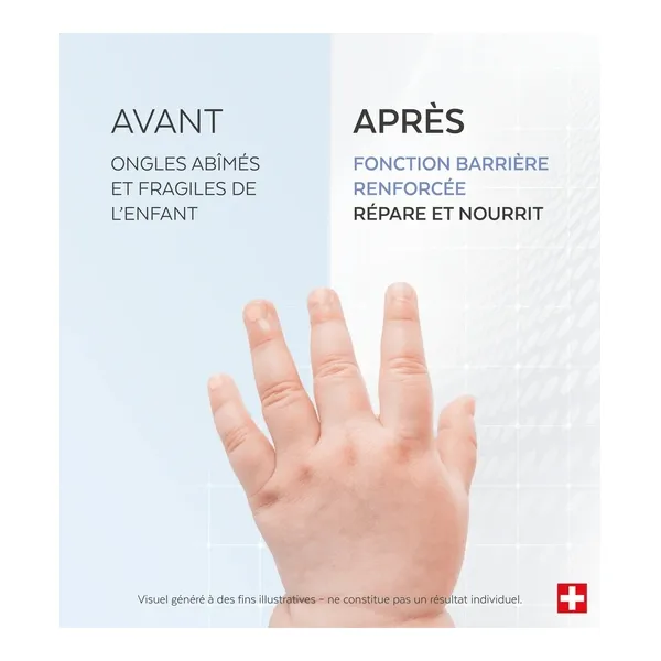 Poderm Ongles abîmés sérum kids
