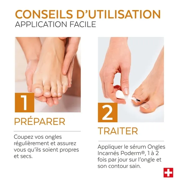 Poderm Ongles incarnés Sérum