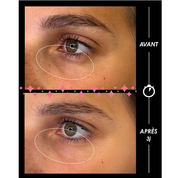 Garancia Larmes De Fantôme contour des yeux