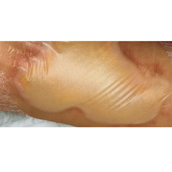 Hartmann Hydrocoll Thin pansement hydrocolloide