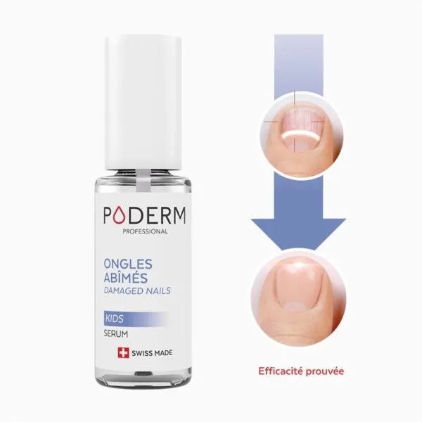 Poderm Ongles abîmés sérum kids